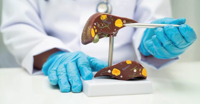 modellino fegato - PIVKA esame oncologico
